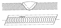 External or Crown Undercut