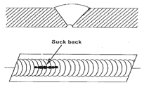 Internal Concavity or Suck Back